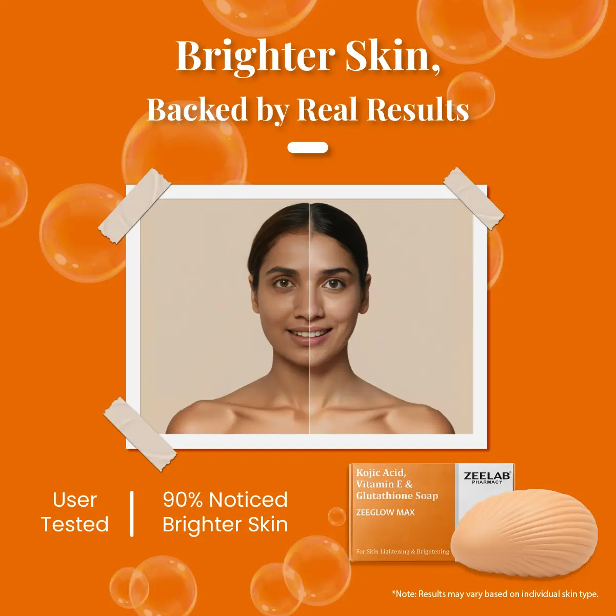 Zeeglow Max | Kojic Acid and Glutathione Soap​ with Vitamin E | For Glowing Skin